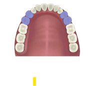 Upper dentures from inside showing row of teeth