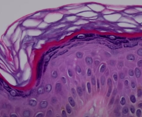 Purple image of skin layers