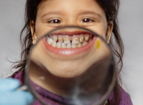 Magnifying glass held in front of girls teeth